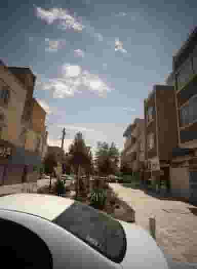 مرکز تخصصی اپیلاسیون برکت در محله امامیه مشهد 