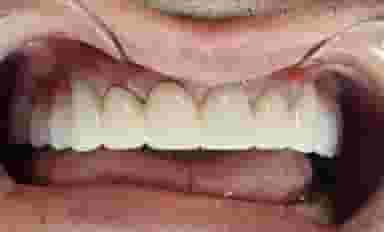 مرکزدندانپزشکی وایمپلنت ودندانپزشکی زیبایی دکتر مهردادافتحی در شکوفه تهران