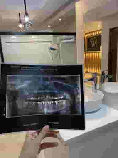 دندانپزشکی دکتر دنیا رشنو در جنت آباد جنوبی تهران