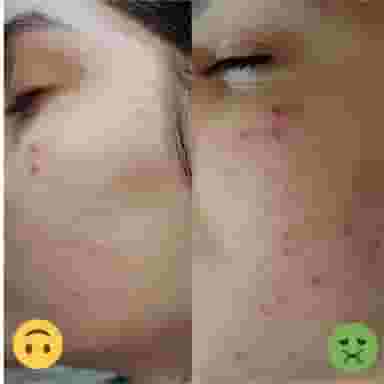 مرکز پاکسازی تخصصی پوست اسپا نیکناز در مهرویلا کرج