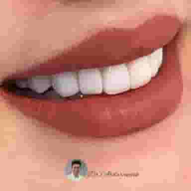 مطب دندانپزشکی دکتر آبدارنده در قصرالدشت شیراز