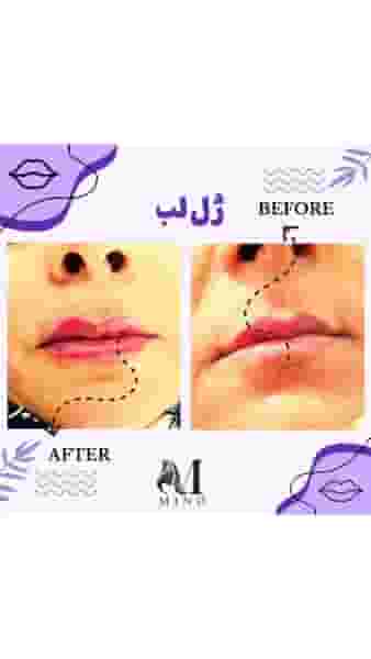 مجموعه زیبایی مینو در حکیمیه تهران