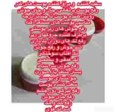 کرم تخصصی نهال قم