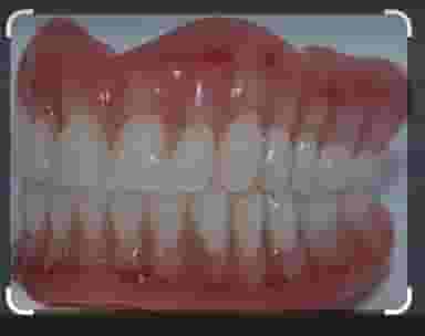 دندانسازی سعید جوادی در جمهوری اسلامی الیگودرز