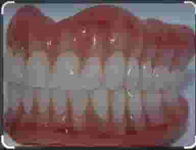 دندانسازی سعید جوادی در جمهوری اسلامی الیگودرز