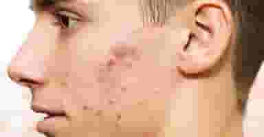 مرکز پوست و مو و زیبایی نیلا در سادات شوشتر