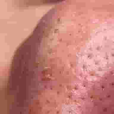 پاکسازی پوست تخصصی آقایان در شهر قدس