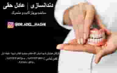 دندانسازی عادل حقی در چهلستون گرگان