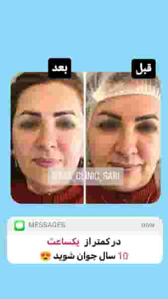 کلینیک زیبایی و لاغری آسا در طبرسی ساری