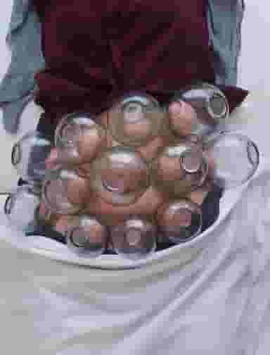 کلینیک طب سنتی آرامش(ماساژوحجامت) در شریعتی کرمانشاه