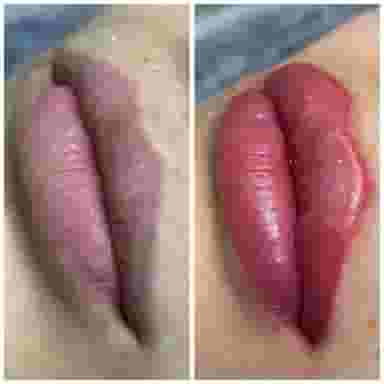 تاتوی اَرو، در چقا گلان کرمانشاه