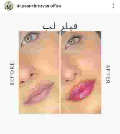 مطب پوست زیبایی لیزر دکتر پونه رضوان در ولیعصر تبریز