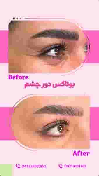 کلینیک زیبایی دکتر مرضیه نیک نفس در ولیعصر تبریز