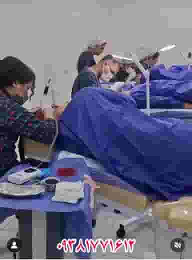 کاشت مو کتکی در کیانپارس اهواز