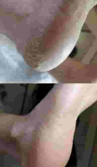 کاشت ناخن مشهد