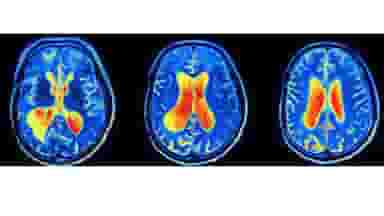  پزشکی هسته ای آسیا در سعادت آباد