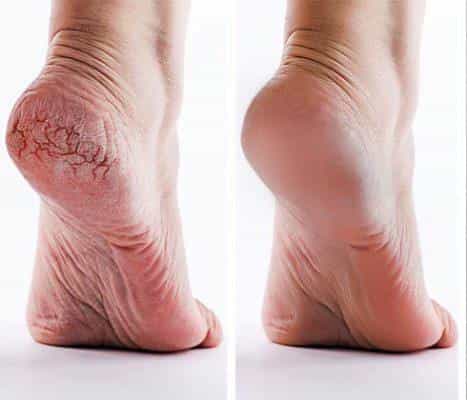 عکس آرایشگاه و آموزشگاه مراقبت زیبایی زهرا عبدی در بلورسازی