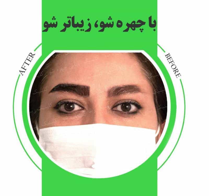عکس کلینیک زیبایی چهره شو در ولنجک