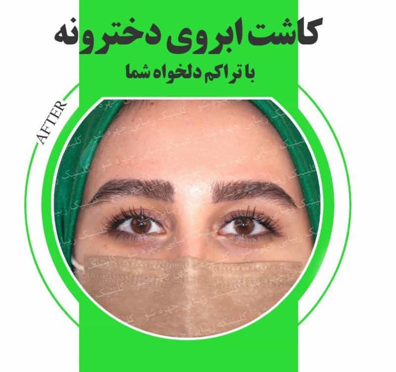 عکس کلینیک زیبایی چهره شو در ولنجک