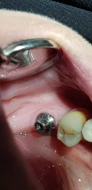 عکس مطب دندانپزشکی دکتر روح اله میراحمدی در محله تالار اصفهان 