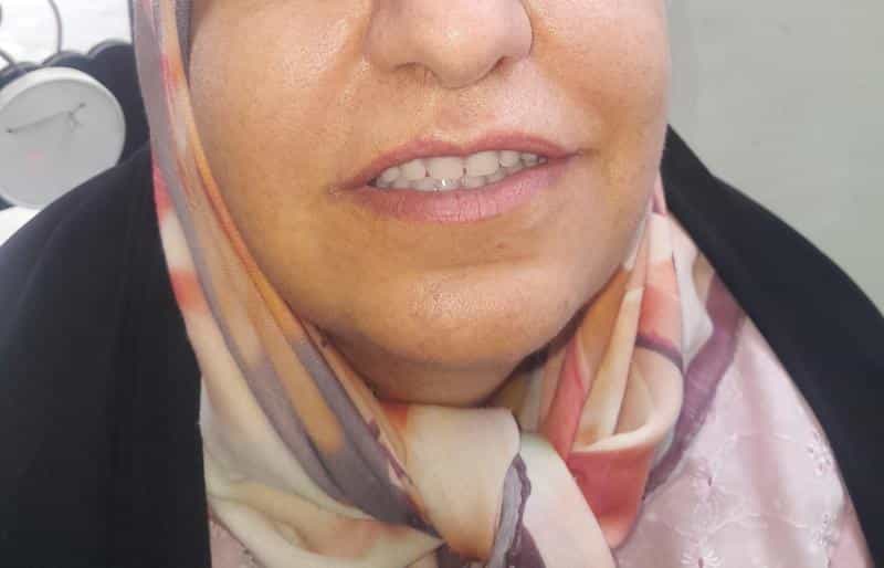 عکس دندانسازی الماس شعبه ۱ در باقوشخانه اصفهان