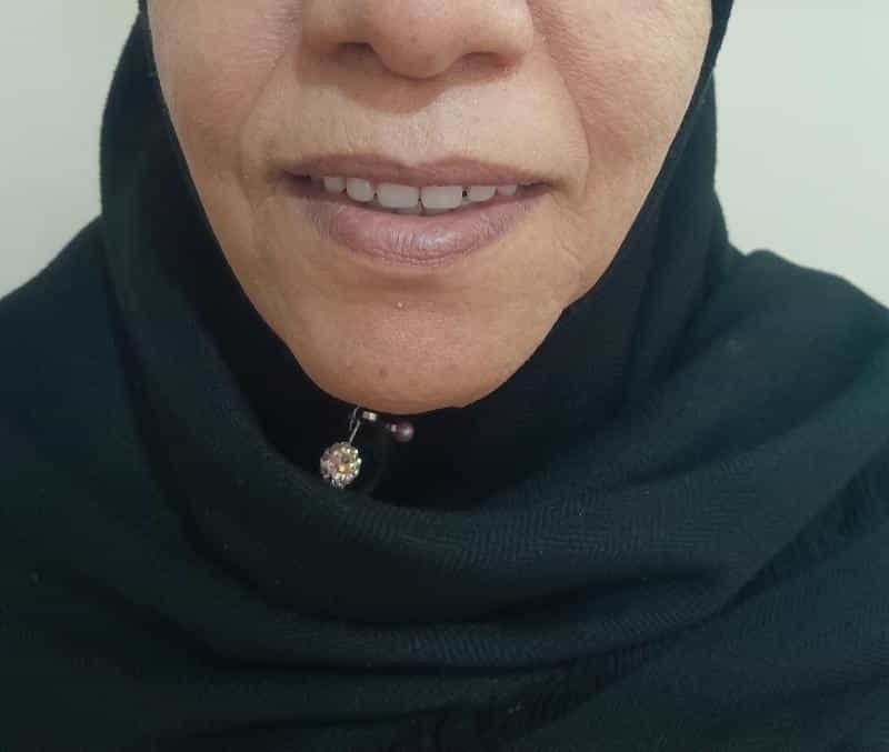 عکس دندانسازی الماس شعبه ۱ در باقوشخانه اصفهان