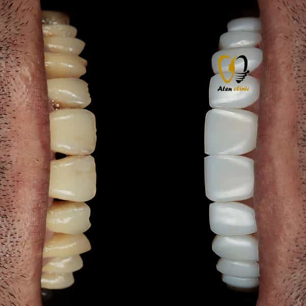 عکس کلینیک دندانپزشکی و زیبایی آتن
