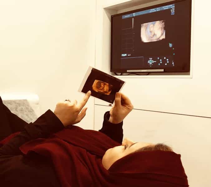 عکس سونوگرافی نیلو دکتر مهتاب قربانی در توانیر تهران