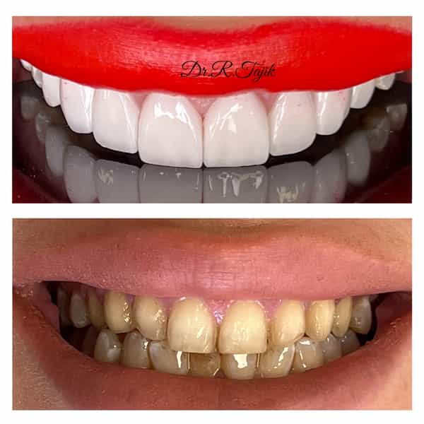 عکس دندانپزشکی دکتر رویا تاجیک در جهان شهر کرج