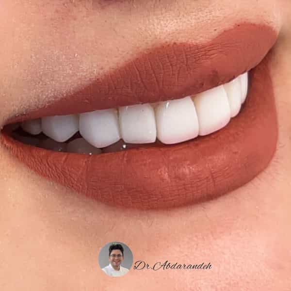 عکس مطب دندانپزشکی دکتر آبدارنده در قصرالدشت شیراز