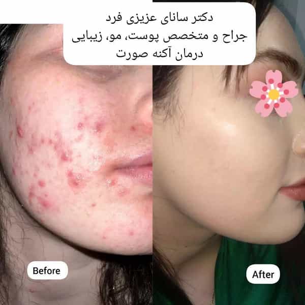 عکس مطب دکتر سانای عزیزی فرد متخصص پوست مو زیبایی لیزر در ولیعصر تبریز