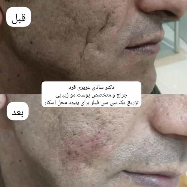 عکس مطب دکتر سانای عزیزی فرد متخصص پوست مو زیبایی لیزر در ولیعصر تبریز