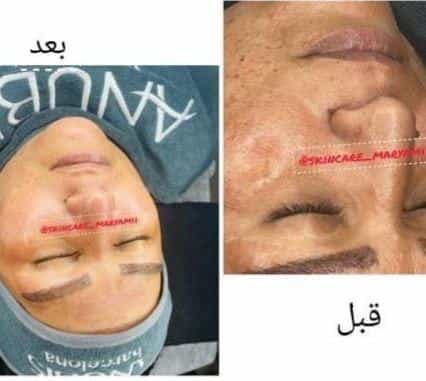 عکس سالن زیبایی ماتیک در کپرها بندرعباس