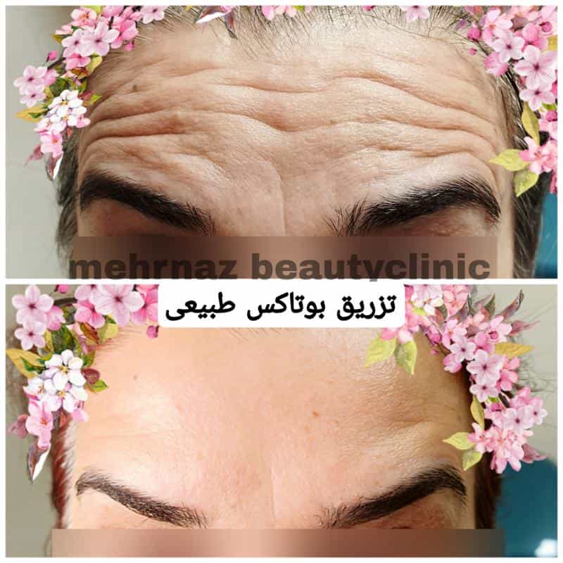 عکس مرکز لیزر،پوست و مو مهرناز در سهروردی