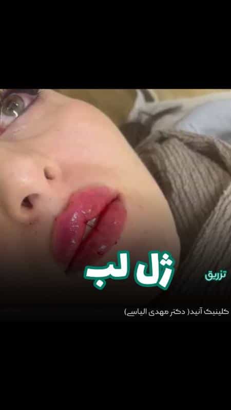 عکس کلینیک زیبایی آنید