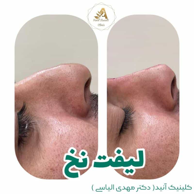 عکس کلینیک زیبایی آنید