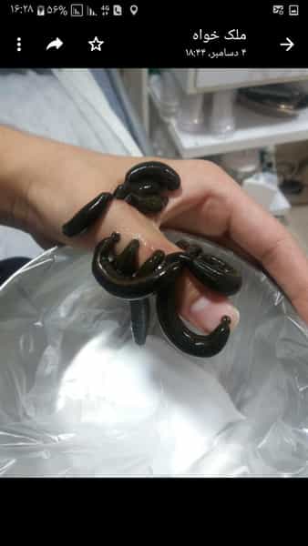 عکس فروشگاه زالو طبی وآرایشی TORK در شبیری 