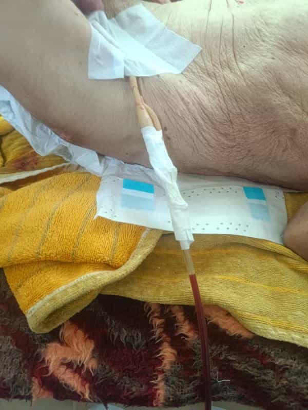 عکس تزریقات پانسمان زخم بستر فصد ویزیت در منزل تبریز