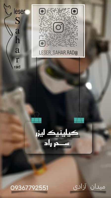 عکس لیزر سحر راد در اصفهان