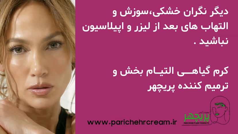 عکس محصولات گیاهی پریچهر در نجارها خمینی‌شهر