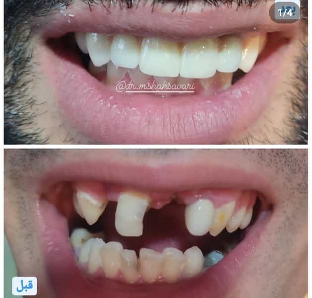 عکس دندانپزشکی دکتر شهسواری در شهر بوکان