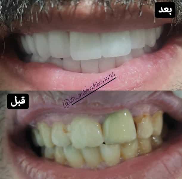 عکس دندانپزشکی دکتر شهسواری در شهر بوکان