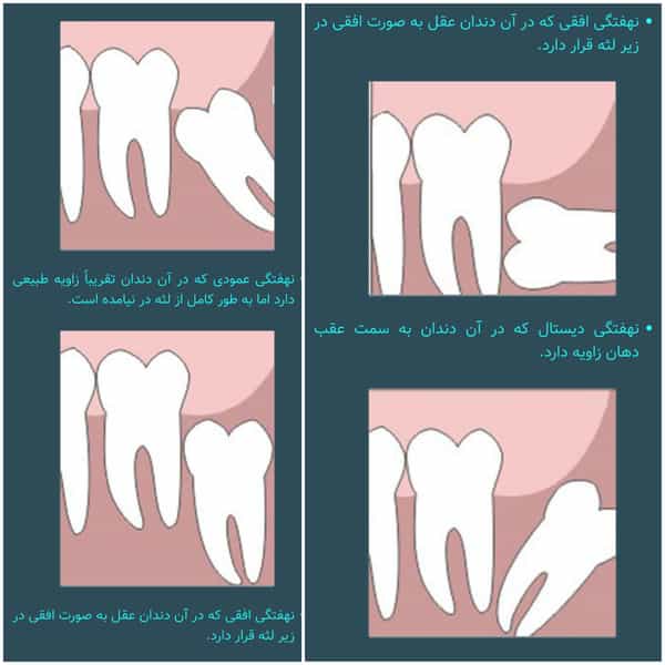 عکس جراح دندانپزشک و دندانساز دکترسارا عباسپور ابیانه در امام خمینی قائم شهر