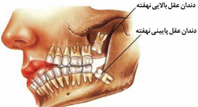 عکس جراح دندانپزشک و دندانساز دکترسارا عباسپور ابیانه در امام خمینی قائم شهر