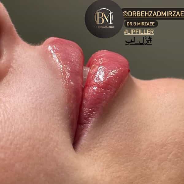 عکس کلینیک زیبایی دکتر بهزاد میرزایی 