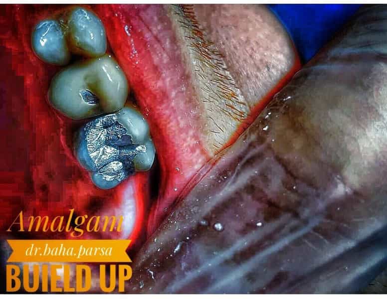 عکس دکتر بهادر بابایی پارسا شهرک ناز فردیس