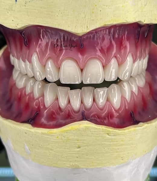 عکس دندانسازی علی عظیمی (صدف) در محلاتی محلات