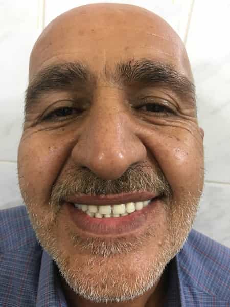 عکس دندانسازی محلات ( فتح المبین ) در انقلاب محلات
