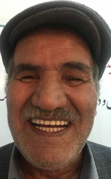 عکس دندانسازی محلات ( فتح المبین ) در انقلاب محلات