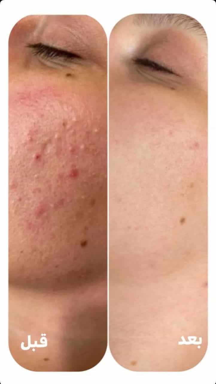 عکس خدمات فوق تخصصی پوست مژگان صالحی